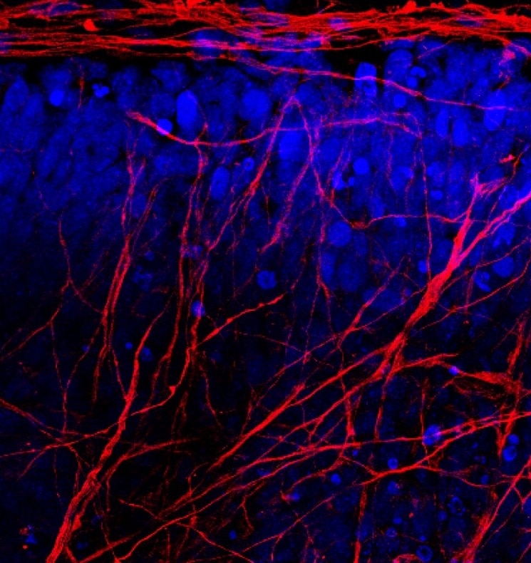 Brain organoid research at Autica Bio Brain organoid research at Autica Bio
